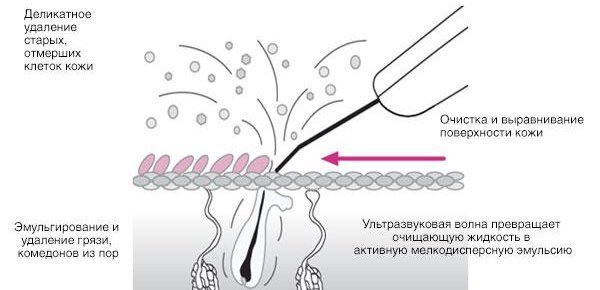 Купить bio sonic 2000 для ухода за кожей лица