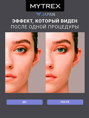 Аппарат для лифтинга лица и ухода за волосами PROVE MYTREX 13